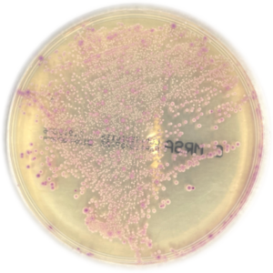 CHROMagar™ MRSA